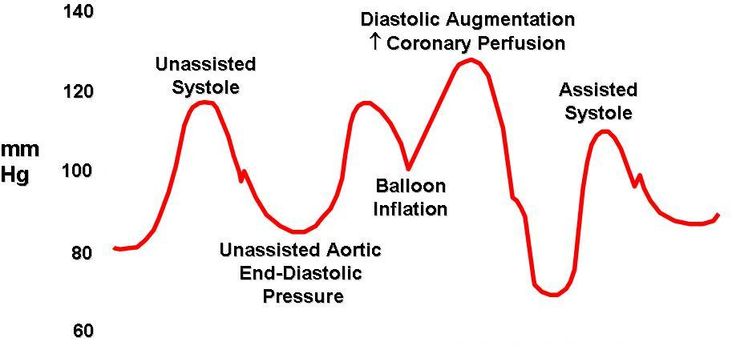 an image of a wave diagram with different types of waves