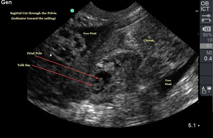 an x - ray shows the location of two different areas in the area that appears to be