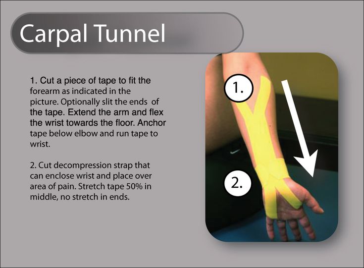 Rocktape kinesiology taping technique for pregnancy carpal tunnel Kt Tape For Carpal Tunnel, Kt Tape Carpal Tunnel, Tia Chi, Carpal Tunnel Relief, Physical Therapy Student, Acupuncture Benefits, Kinesio Tape, Kt Tape, Kinesio Taping