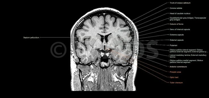 an mri scan shows the location of the brain and its major areas, including the frontal area