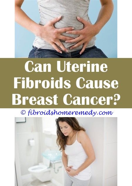 Uterine Fibroids Bloated Stomach | Uterine fibroids, Fibroids, Uterine ...