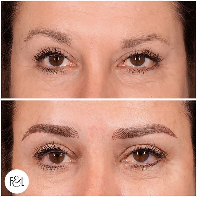 Balancing a naturally high-low set of brows comes with it's own unique challenges. We needed to correct the symmetry without changing the placement of Karin's natural brow too extremely. It is true that brows are sisters not twins but if your brows currently look like distant cousins, we would love to help get them more acquainted! 👯👌#browsaresistersnottwins #browbalance Cosmetic Tattoo, Natural Brows, Eyebrow Tattoo, Tattoo On, We Need, High & Low, Eyebrows, High Low, Twins