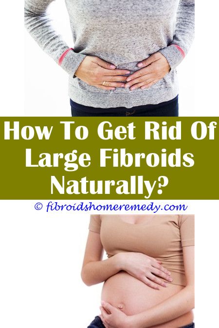 Pin on Fibroid Surgery Recovery Time