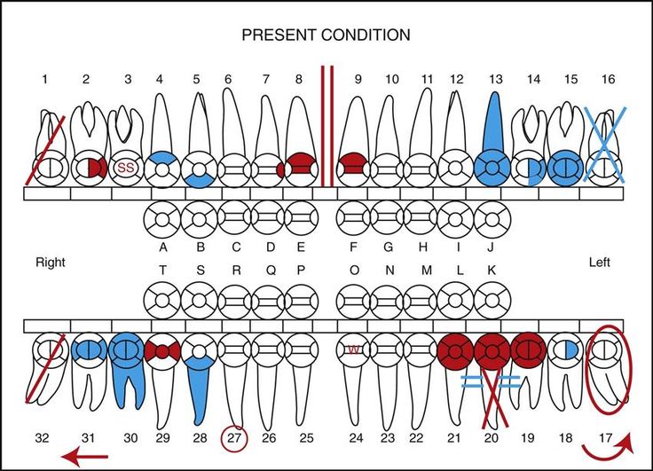 Pin by Claudette Gaba on Dental | Dental charting, Tooth chart, Dental