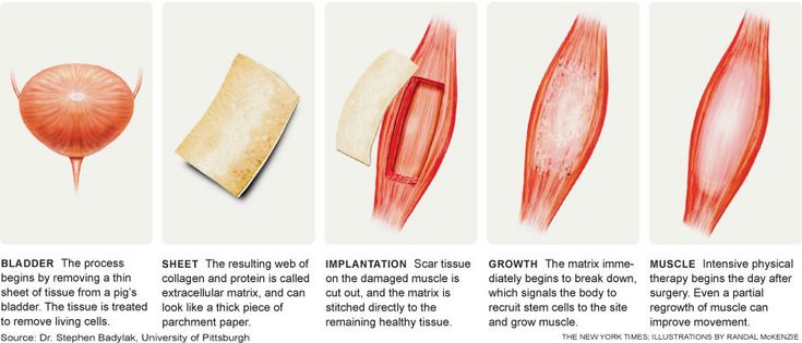 Remodeling Muscle Muscle Physiology, 2 Week Diet, Scar Tissue, Scaffolding, The Human Body, Anatomy, Human Body, Diet, Human