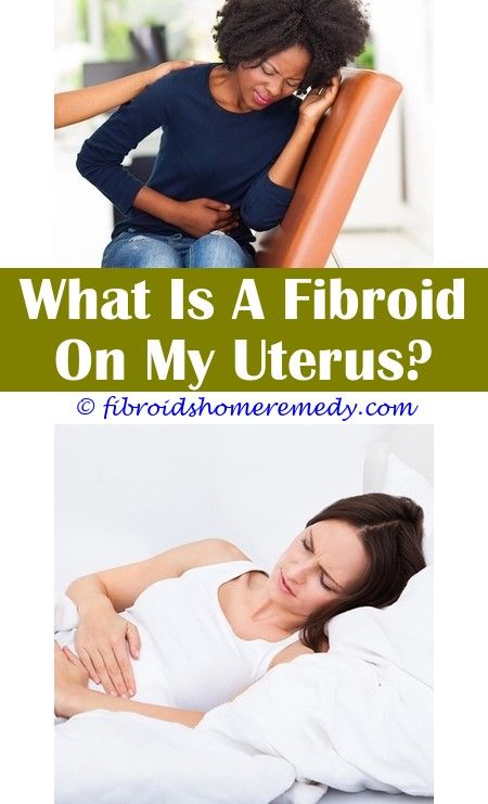 Pin on Fibroids And Weight Gain