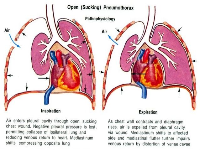 diagram of the heart and lungs