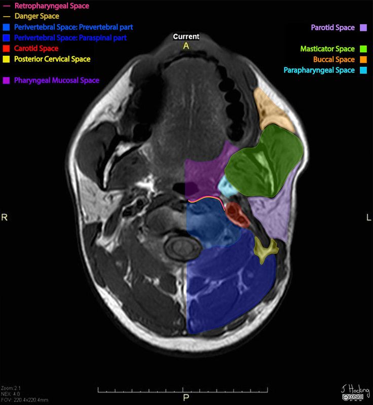 an mri scan shows the location of the brain and its major functions in different areas