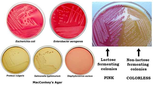 four different types of colored pigments are shown in this diagram, including pink, yellow and green