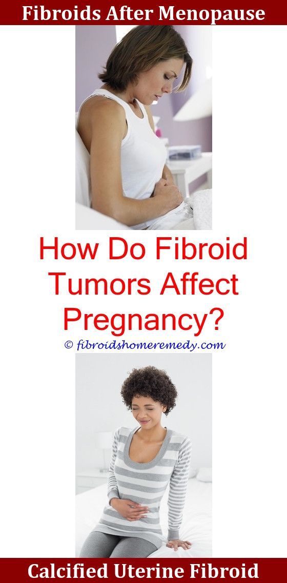 Are Fibroids Common What Causes Fibroids,what are the signs and ...