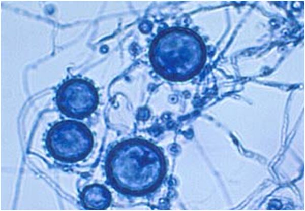 an image of some blue and white cells