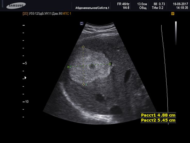 Pin on Ultrasound