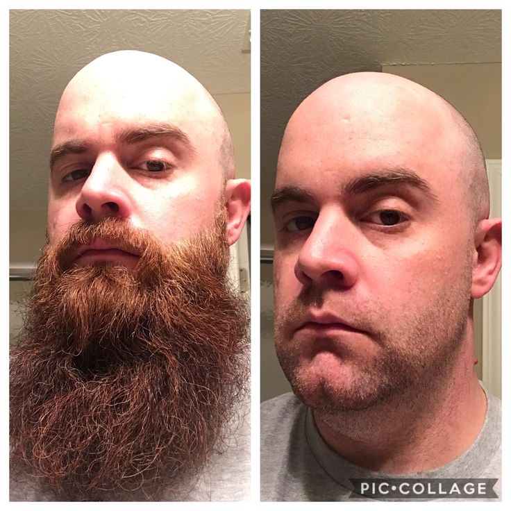 Shaving Your Beard Is Bad