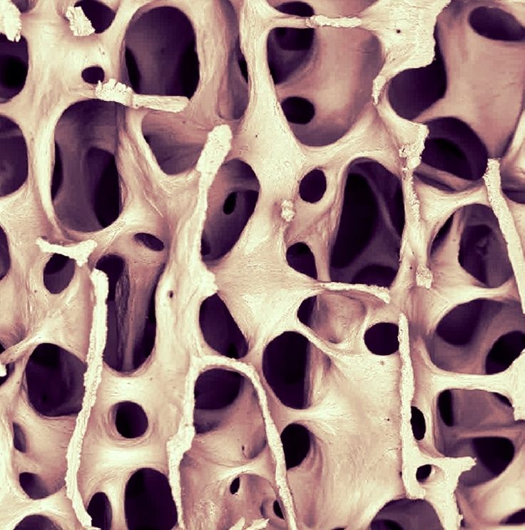 the structure of an animal's bone is shown in black and white, with holes on