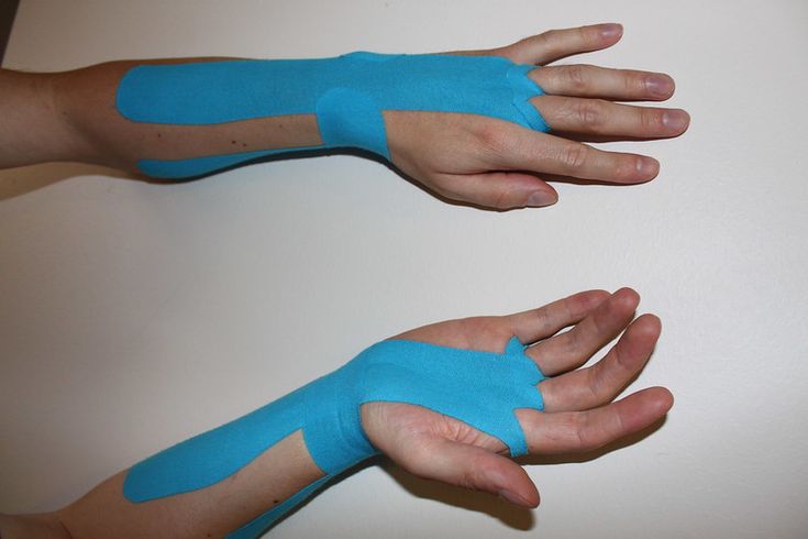 Carpal tunnel - Physio Tape, Carpal Tunnel Exercises, Carpal Tunnel Relief, K Tape, Kinesio Tape, Kt Tape, Kinesio Taping, Sports Tape, Kinesiology Taping