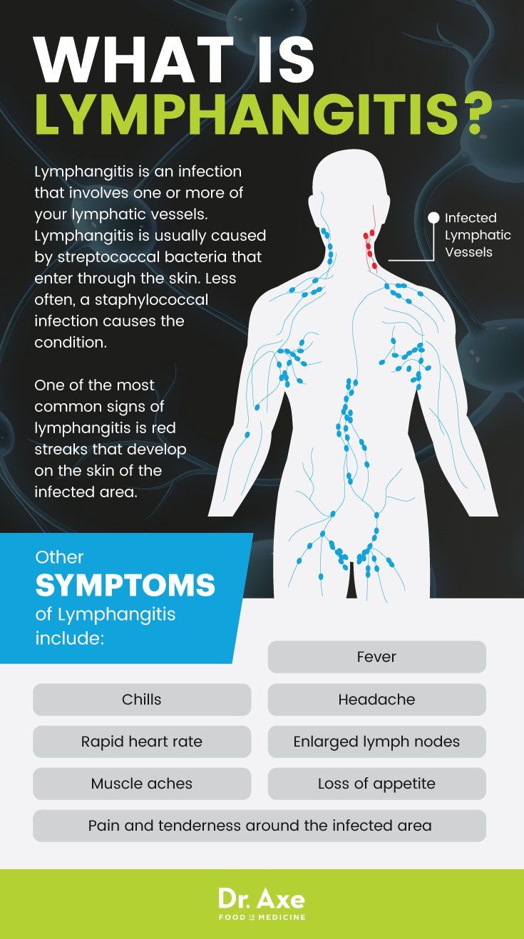 What is lymphangitis? - Dr. Axe Swollen Lymph Node Remedies, Lymph Node, Natural Antibiotic, Drainage Massage, Lymph System, Skin Bumps, Lymph Drainage, Maintain Weight, Natural Antibiotics