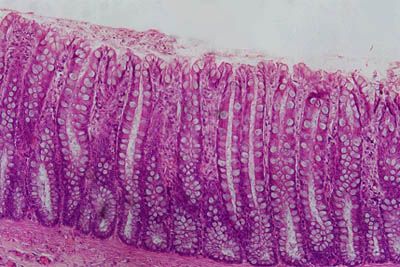 an image of the inside of a human cell