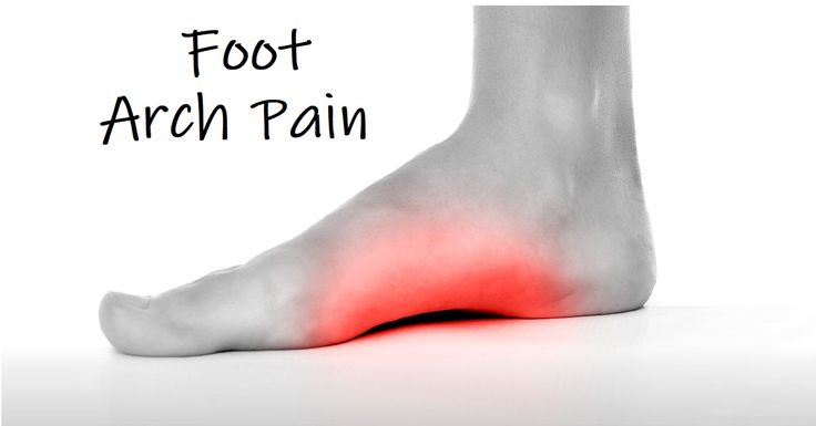 Foot Arch Pain: Common causes and treatments for pain on the bottom of the foot Ankle Problems, Optimum Health, Broken Ankle, Medical Anatomy, Foot Pain, Health Awareness, Arch, Nutrition, Personal Care