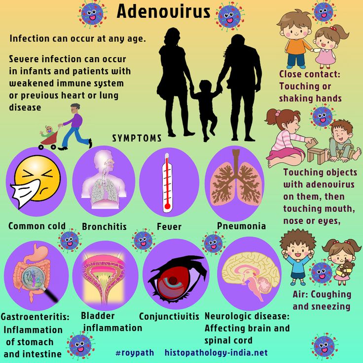 Adenoviruses typically cause self-limited respiratory, gastrointestinal, or conjunctival disease throughout the year, without significant seasonal variation. Adenovirus infections are most common among children, people living in close quarters (such as college students and military recruits), and immunocompromised patients. . . .#roypath #pathology #histopathology #adenovirus #infectiousdisease Nclex Practice Questions, Nuclear Membrane, Respiratory Infection, Disease Symptoms, Respiratory Diseases, Respiratory, Medical Knowledge, Acupressure, Pediatrics