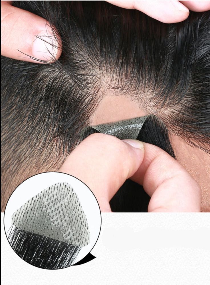 Hair patch to cover the temples of the head for men with hair loss or a receding hairline.5 sizes available length 15cm Hair Patches For Men, Hairline Growth, Hair Pieces For Men, Hair 2025, Upper Lip Hair, Traction Alopecia, Hair Glue, Bald Patches, Short Weave