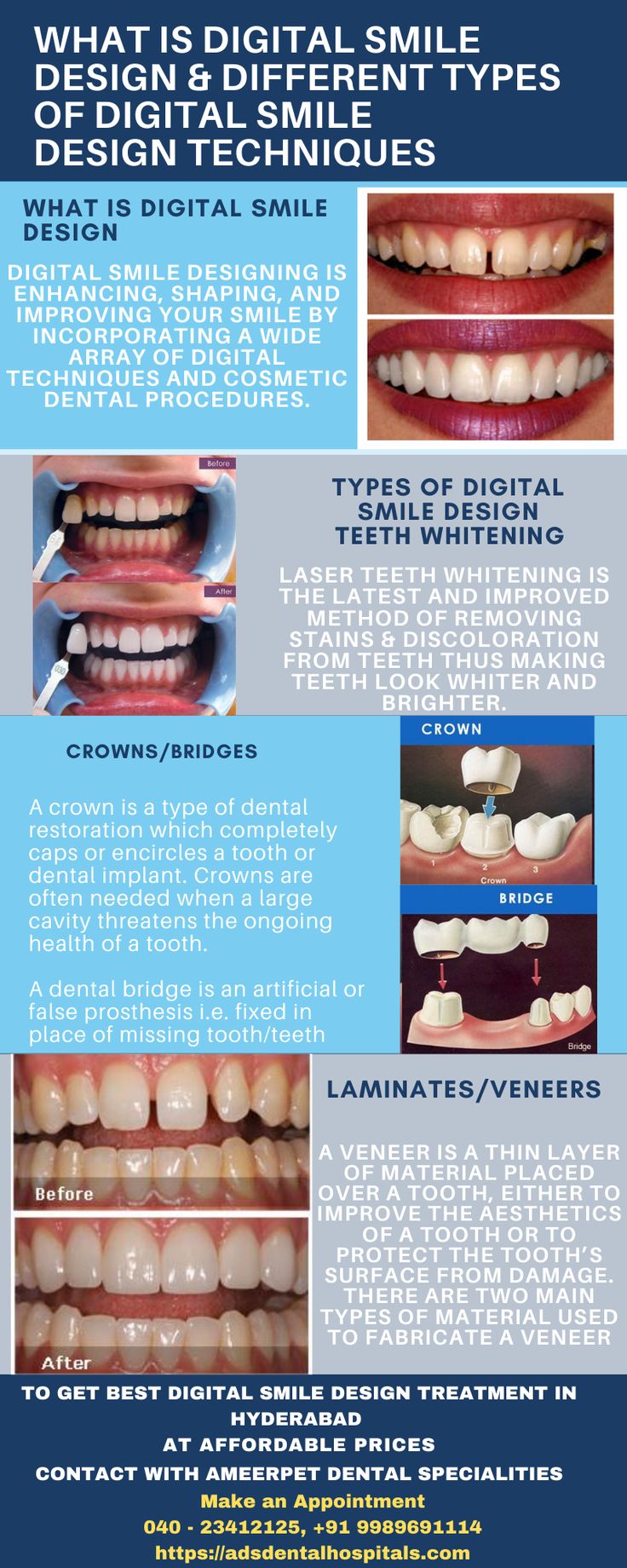 Smile and laugh out loud with our attractive Smile Designing. The best digital smile designing is now in Hyderabad at Ameerpet dental specialities. Digital Smile Design Dental, Smile Design Dental, Digital Smile Design, Attractive Smile, Dental Smile, Medical Items, Dental Videos, Dental Health Care, Dental Hospital