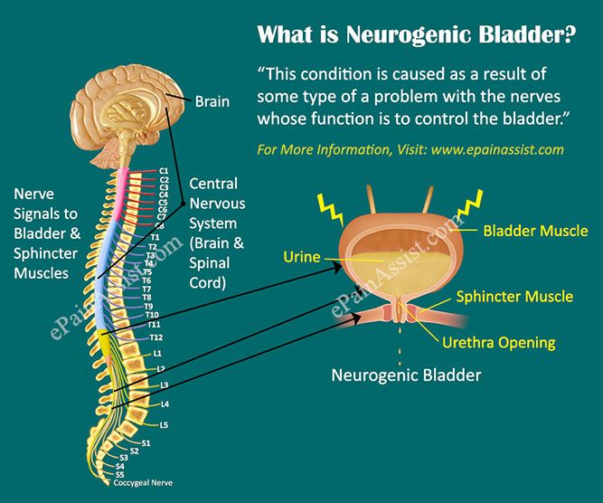 what is neurogenic bladder? this condition is used as a result of those type of function in the nervous system