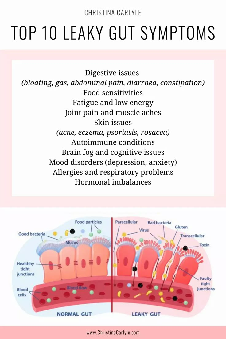 Wondering what the heck is leaky gut? Learn what leaky gut is, the top causes, and 5 easy steps to heal leaky gut and reverse symptoms. Constipation Food, Leaky Gut Symptoms, Christina Carlyle, Leaky Gut Diet, Heal Leaky Gut, Gut Health Diet, Gut Healing, Food Sensitivities, Leaky Gut