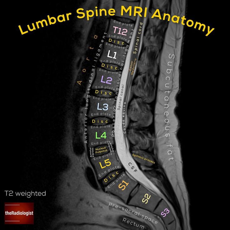 an mri image with the words lumbar spine mri anatomy in black and white