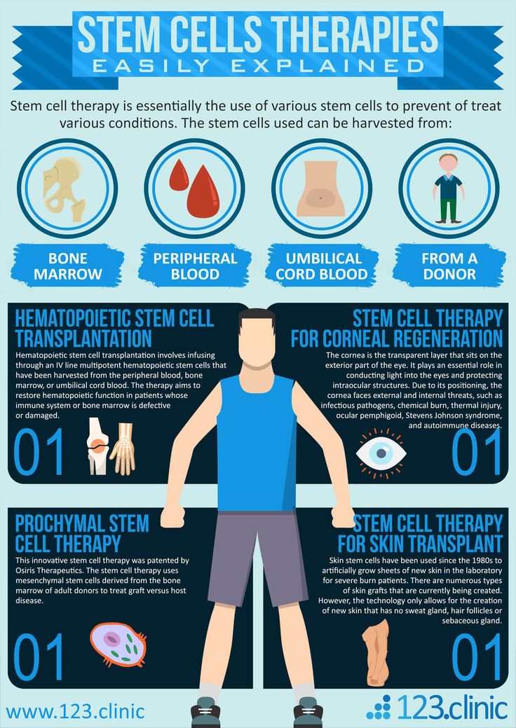 Stem cell therapy is essentially the use of various stem cells to prevent or treat various conditions. The stem cells used can be harvested from the patient’s bone marrow, peripheral blood, umbilical cord blood and or from a donor. Although the immense healing properties of stem cells have been known for decades, currently very few stem cell treatments have been proven to be effective and safe… #infographics Cell And Molecular Biology, Specialised Cells Notes, Specialised Cells, Mesenchymal Stem Cells, Typical Plant Cell, What Is Stem, Stem Cell Research, Cord Blood Banking, Cells Project