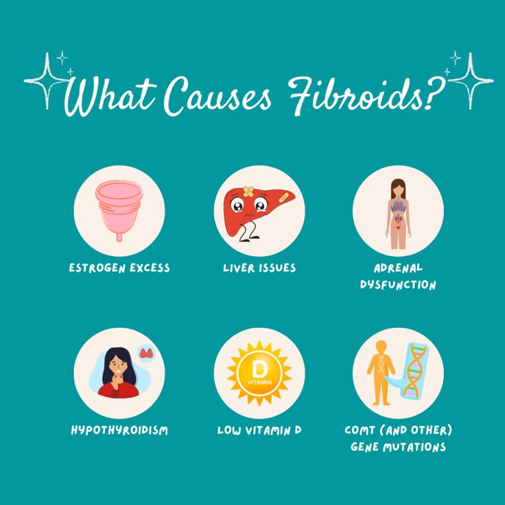 Uterine Fibroid Measurement Chart