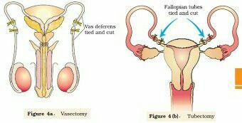 Natural Family Planning, Contraception Methods, Fallopian Tubes, Biology Notes, Class 12, Family Planning, Reproductive Health, Create Awareness, Birth Control