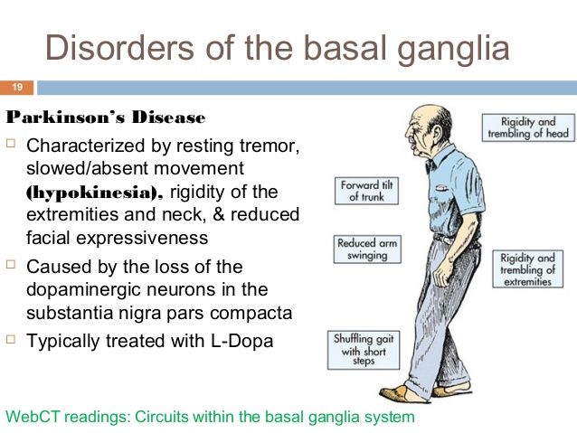 basal ganglia disorders - Google Search Crna School, Basal Ganglia, Neurology, School Fun, Nursing School, Disease, For Free, Google Search, Memes