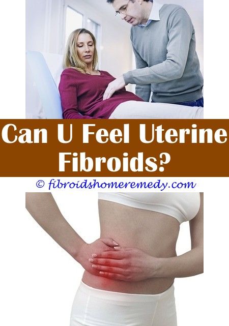 Can You Pass Fibroids During A Period | Fibroid tumors, Fibroid surgery ...