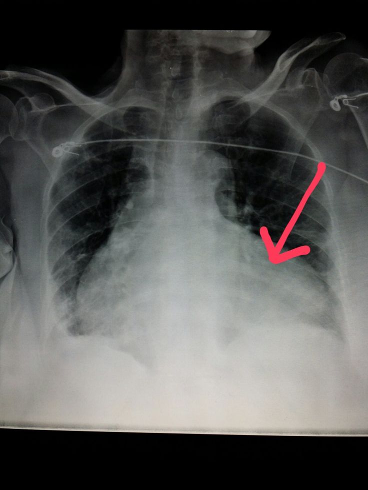 Pin on Unusual X-rays