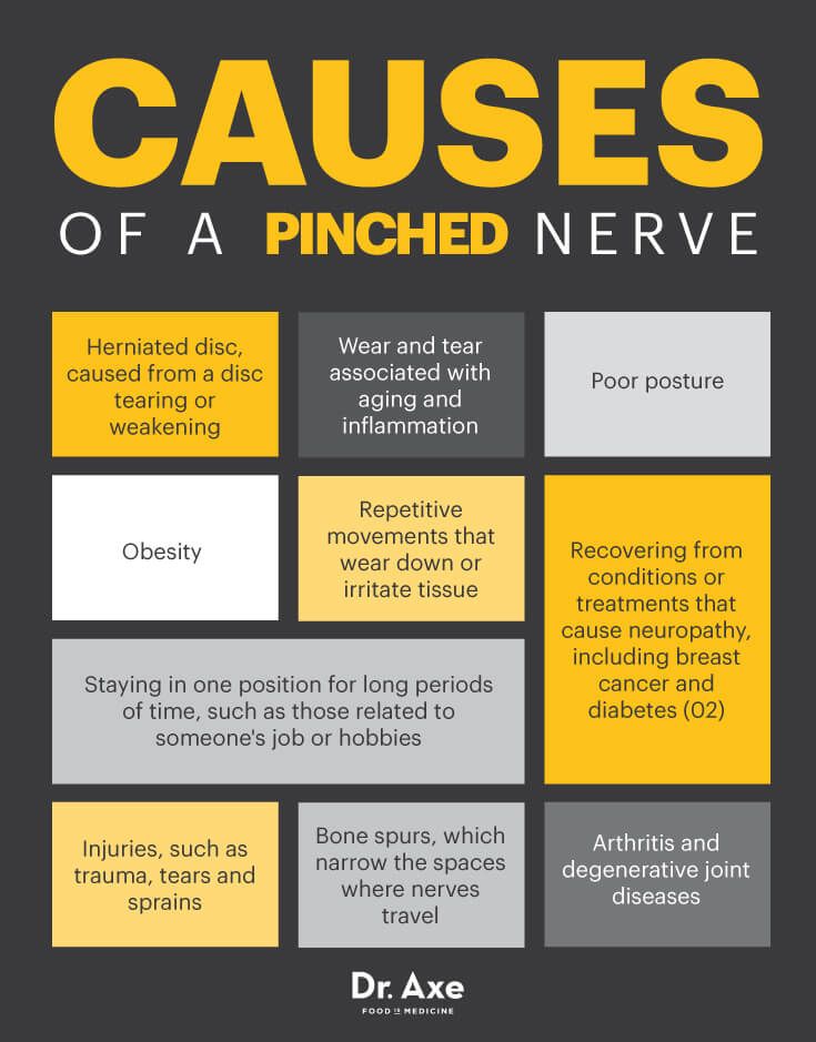 Pinched nerve causes - Dr. Axe #health #holistic #natural Pinched Nerve Relief, Nerve Relief, Pinched Nerve, Sciatic Nerve Pain, Sciatica Pain, Sciatic Nerve, Nerve Pain, Back Pain Relief, Sciatica