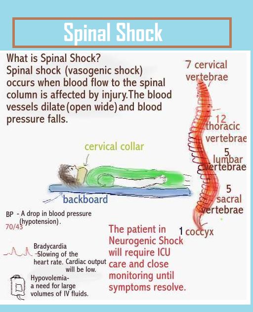 the diagram shows how to use spin shock