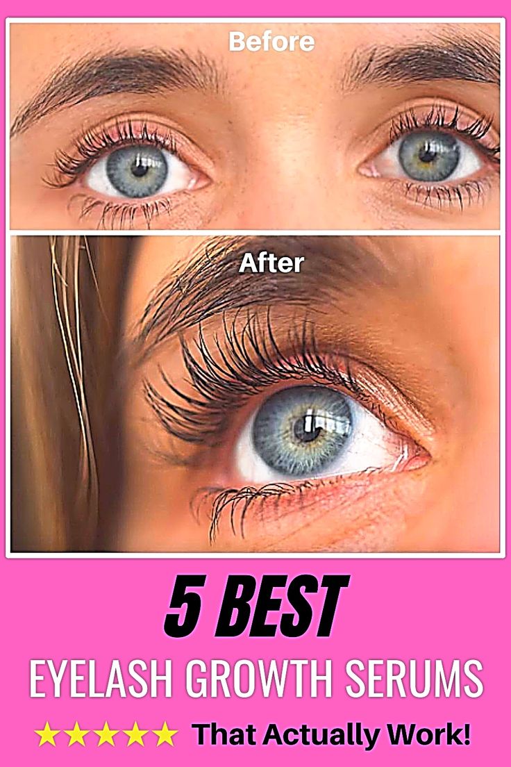 100 Women Just Like You Tested 30 Eyelash Growth Serums and share with you the 5 Best! Eyelash Growth Vaseline, Eyelash Growth Cycle, Oil For Eyelash Growth, Eyelash Growth Diy, Best Eyelash Growth Serum, Grow Eyelashes, Natural Eyelash Growth, Eyebrows And Eyelashes, Lash Growth Serum