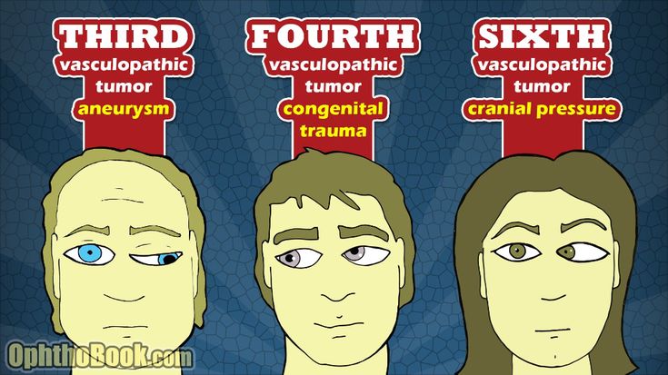 three people with different types of words on their foreheads, and one has the word fourth