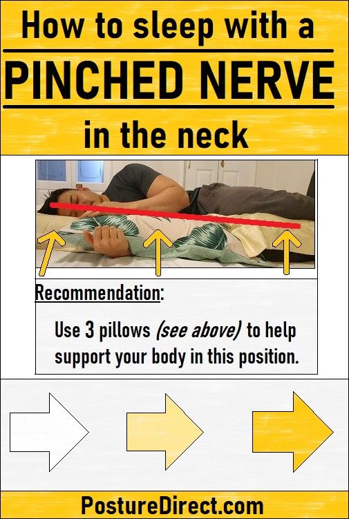 How to sleep with a Pinched Nerve in the Neck | Pinched nerve, Pinched ...