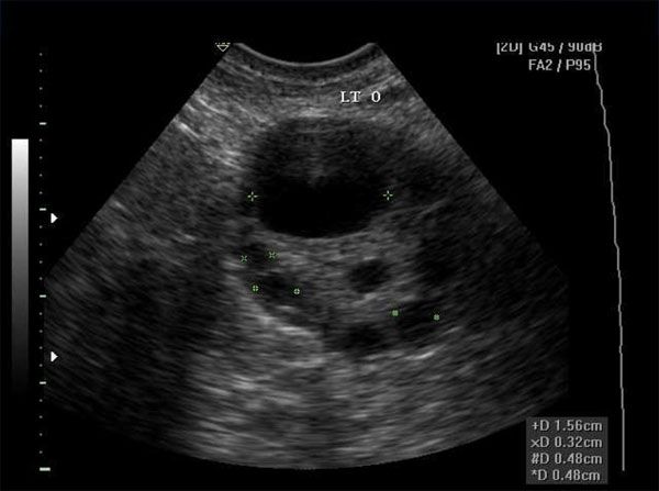 Dominant graafian follicle What phase is this ov in? Ultrasound Sonography, Medical Education, Radiology, Ultrasound, Dream Job, Medical Professionals, Pediatrics, Medical, Quick Saves