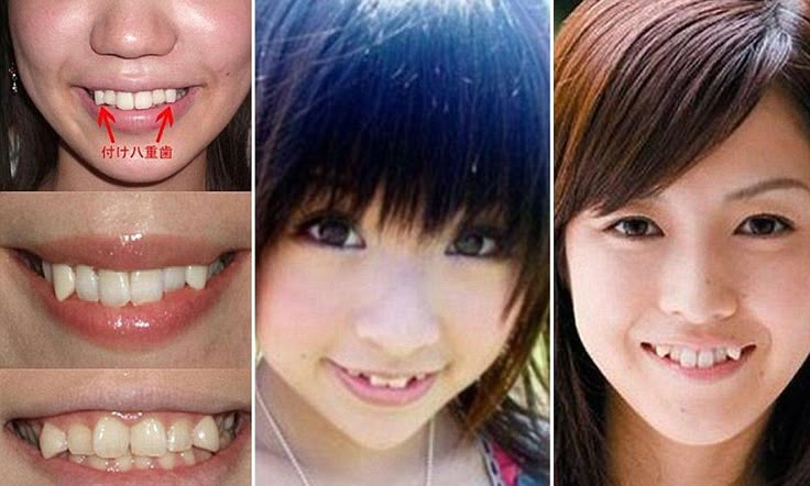 Japanese women paying hundreds of pounds to have crooked, 'fang-like' teeth in latest cosmetic craze Crooked Teeth Pretty, Yaeba Teeth, Dracula Teeth, Fang Teeth, Character Features, Canine Tooth, Bad Teeth, Crooked Teeth, Gap Teeth