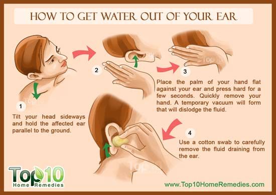 technique to get water out of ear Water In Ear Remedy, Swimmers Ear Home Remedy, Water In Ear, Swimmers Ear Remedy, Fluid In Ears, Valsalva Maneuver, Swimmers Ear, Vicks Vaporub Uses, Top 10 Home Remedies