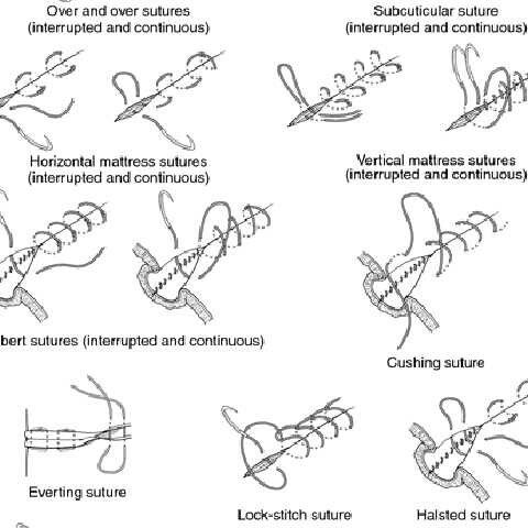 Sutures and knots First Aid, Surgery, Pinterest Likes, Thread, Health