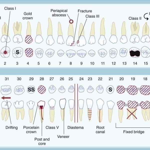 Dental Charting Symbols | World Of Template & Format throughout Dental Charting Symbols Dental Charting Symbols, Dental Assistant Study Guide, Dental Charting, Dental Assistant School, Hygiene School, Dental Assistant Study, Dental Hygiene Student, Dental Assisting, Dental Hygiene School