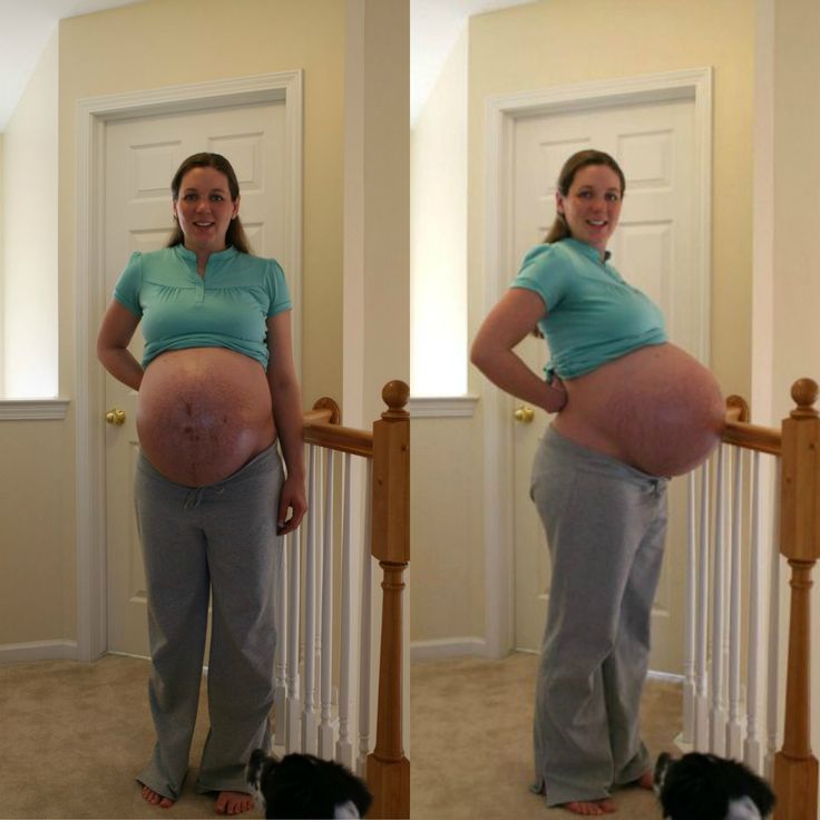 a pregnant woman standing in front of a cat