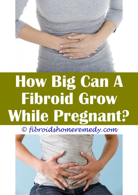 Fibroid Removal During C Section | Fibroid cyst, Fibroids, Uterine ...