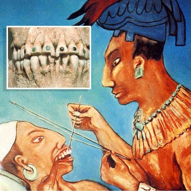 an image of a man getting his teeth brushed by another man with braces in front of him