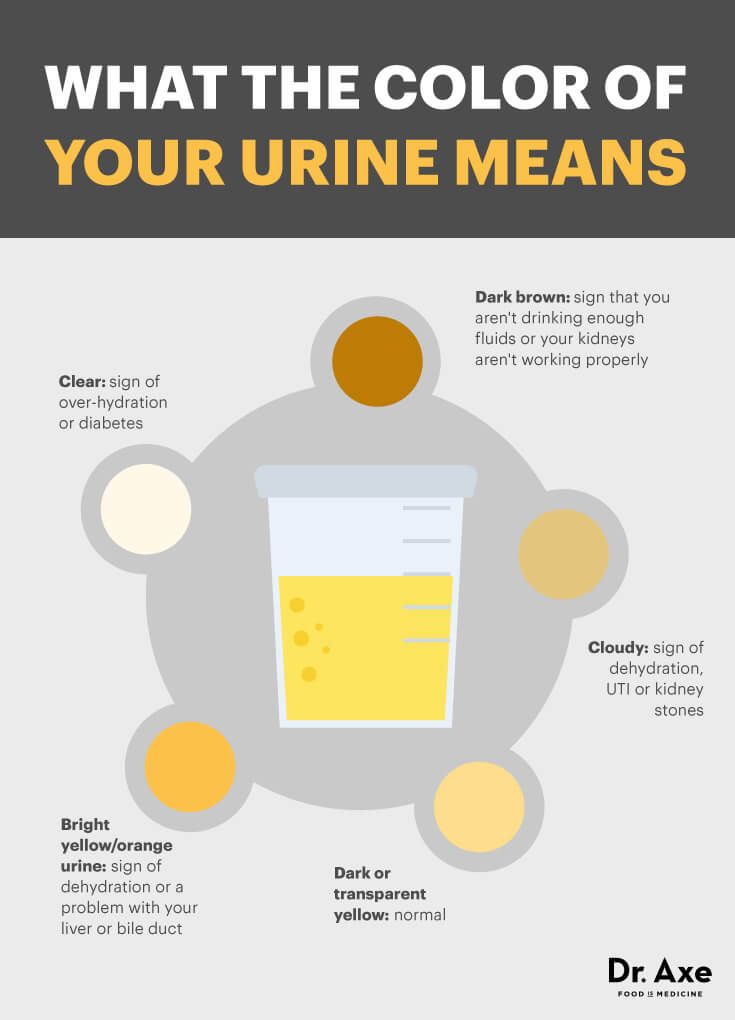 What the color of your urine means - Dr. Axe Color Of Urine, Cloudy Urine, Odd Facts, Kidney Detox, Kidney Health, Bacterial Infection, Urinary Tract, Detox Smoothie, Hormone Balancing