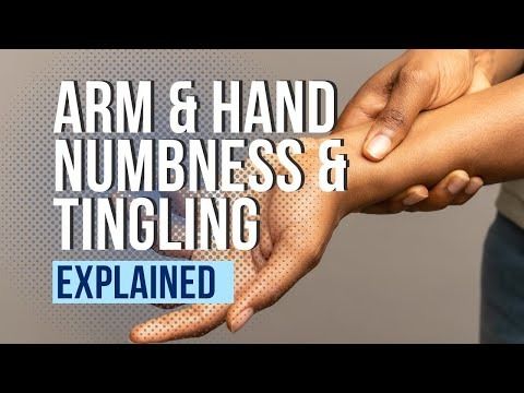 Arm and Hand Numbness and Tingling Explained - YouTube Numbness In Fingers, Tingling Hands, Arm Numbness, Numbness In Hands, Arm Exercise, Online Newsletter, Hand Pain, Word Online, School Communication