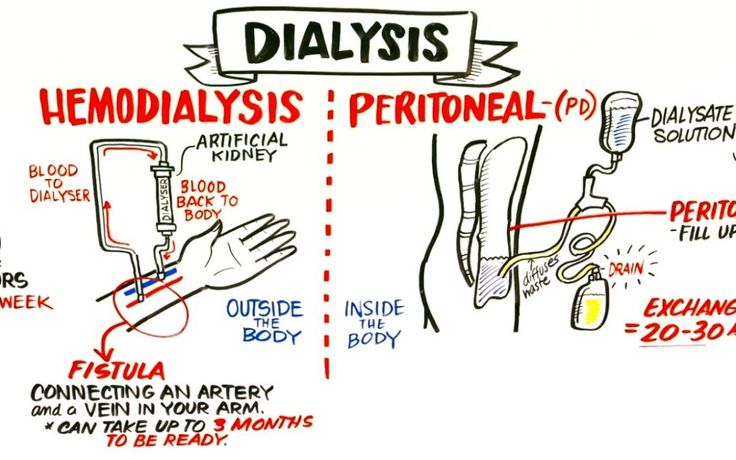 the diagram shows how to use an inhaler and hand sanitizer for hemodialism